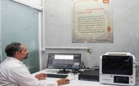 دستگاه تشخیص سریع سل در کهگیلویه و بویراحمد راه‌اندازی شد